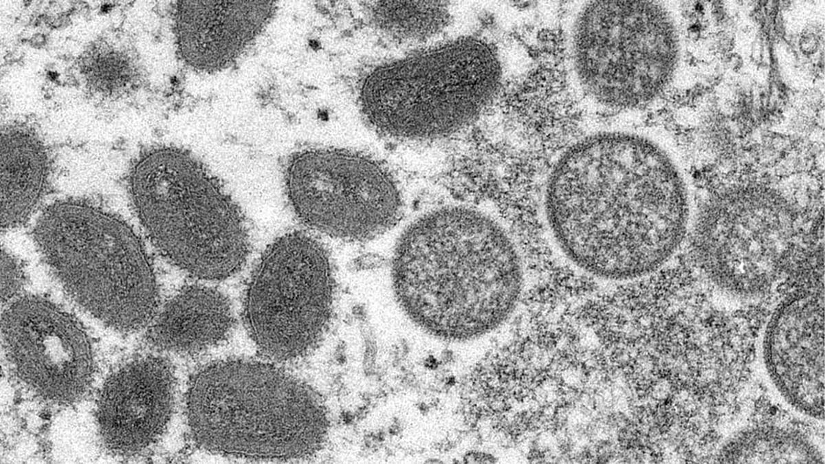 | Phot: UN News  : Philippines Reports More Monkeypox Cases; Africa CDC Warns Of New Challenges 